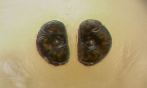 The spiracular plates of a third instar larva (top)
