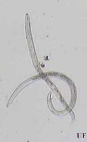 Male and young female of reniform nematode, Rotylenchulus reniformis Linford & Oliveira, stages typically found in soil. Female has a strong stylet (needle-shaped mouthpart). Male (curved specimen) has a weak stylet and a spicule (at posterior) for insemination.