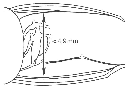 image of Neoconocephalus bivocatus